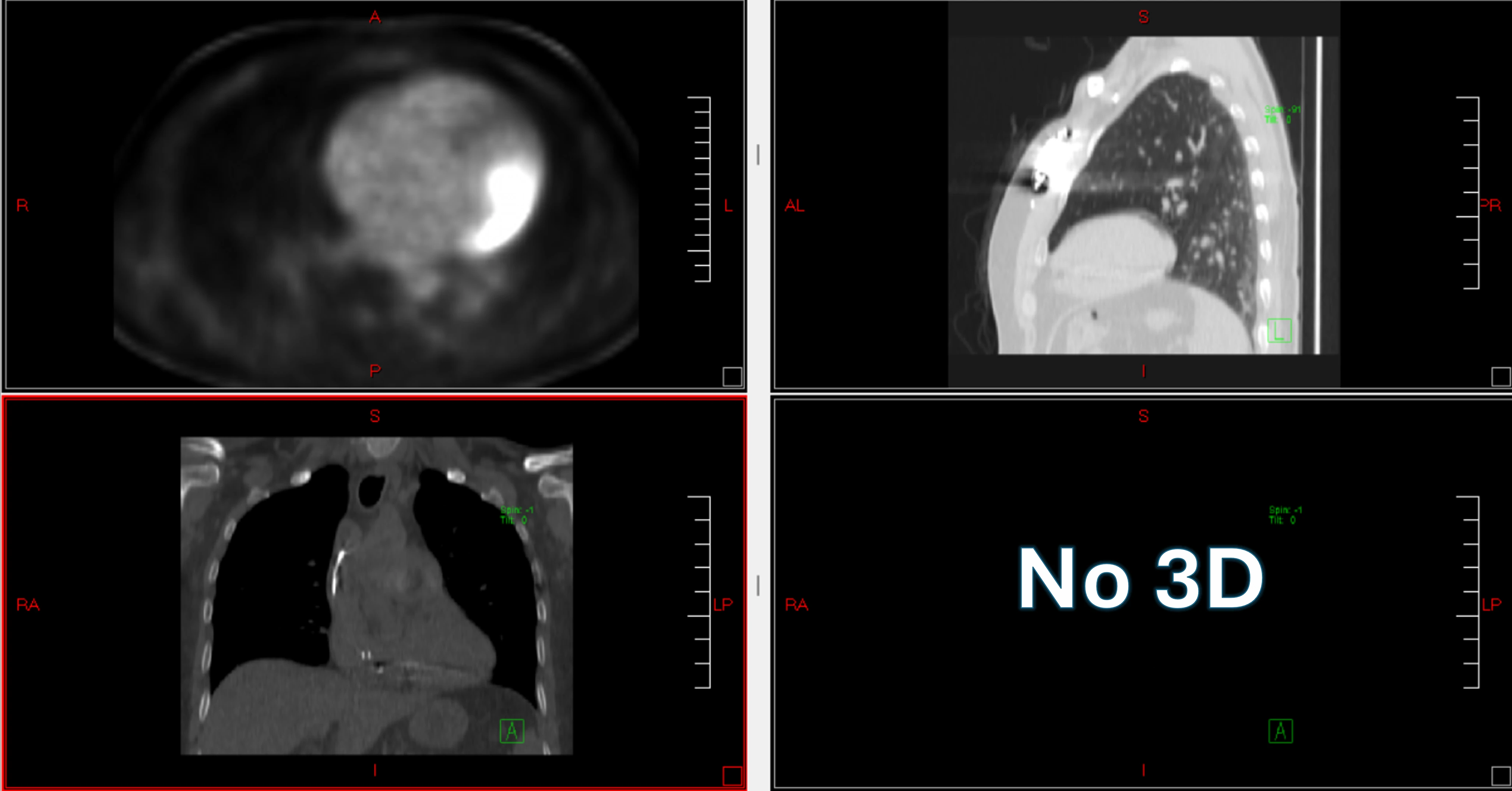Traditional DICOM viewer with four panels showing flat 2D cross-sections and a 'No 3D' panel